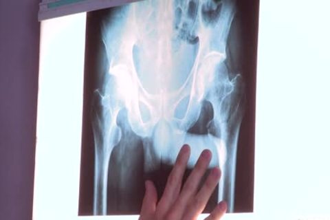 inner Specialists - JJ Knight, Landon Mycles